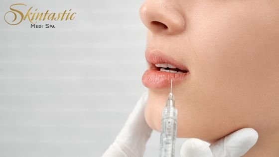 Lip Fillers Riverside