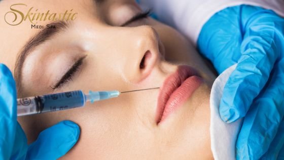 Lip Fillers Riverside